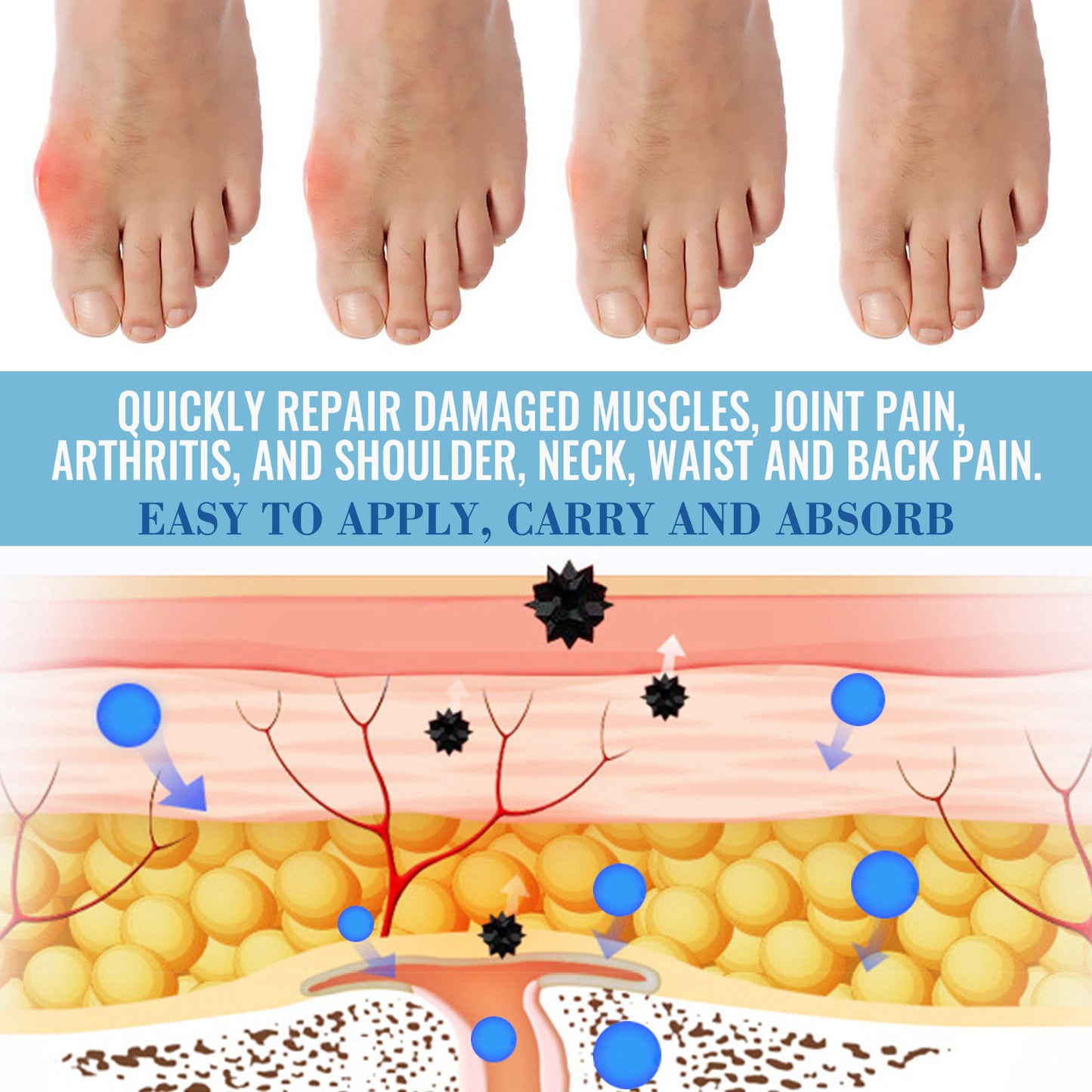 Knee Recovery Gel